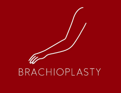 Does Medicare Cover Brachioplasty (Arm Lift) In Newcastle?