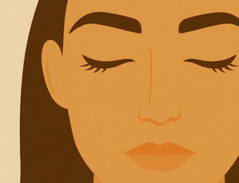 Recovery After Blepharoplasty Performed in Clinic Rooms Under Local Anaesthetic