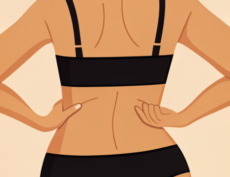 Recovery After Bra Line Back Lift Surgery